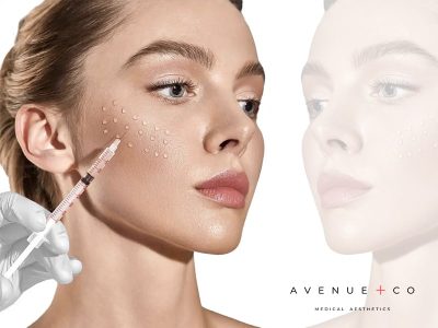 Avenue Skin Booster Treatments-min