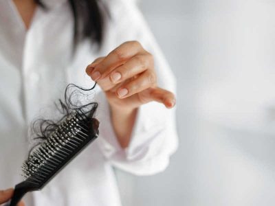 Female Hair Loss-min